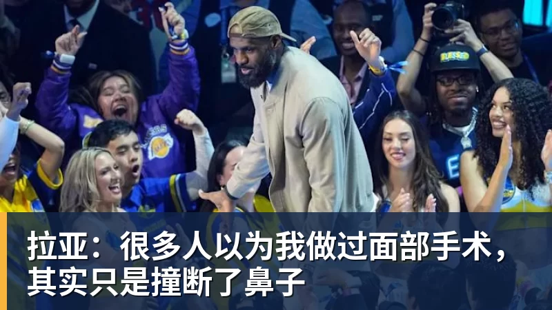 拉亚：很多人以为我做过面部手术，其实只是撞断了鼻子